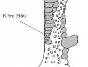 vảy gà xấu