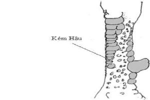 vảy kém hậu